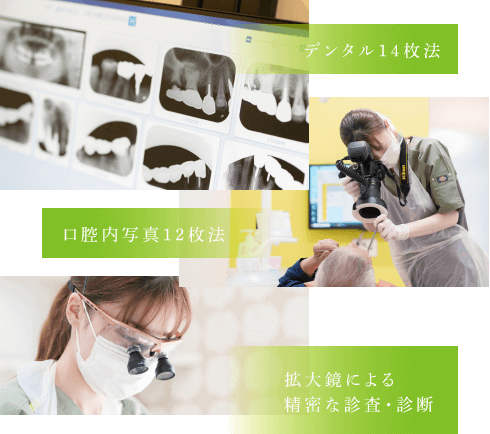 デジタル14枚法、口腔内写真12枚法、拡大鏡による精密な診査・診断