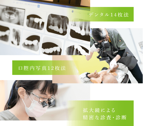 デジタル14枚法、口腔内写真12枚法、拡大鏡による精密な診査・診断